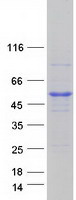 RRAGC / RAGC Protein - Purified recombinant protein RRAGC was analyzed by SDS-PAGE gel and Coomassie Blue Staining