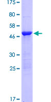 RRAS Protein - 12.5% SDS-PAGE of human RRAS stained with Coomassie Blue