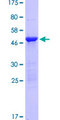 RRAS Protein - 12.5% SDS-PAGE of human RRAS stained with Coomassie Blue