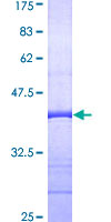 RRAS Protein - 12.5% SDS-PAGE Stained with Coomassie Blue