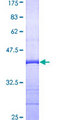RRAS Protein - 12.5% SDS-PAGE Stained with Coomassie Blue
