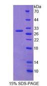 RRBP1 / hES Protein - Recombinant Ribosome Binding Protein 1 (RRBP1) by SDS-PAGE