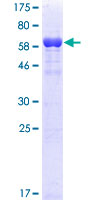 RRM2 Protein - 12.5% SDS-PAGE of human RRM2 stained with Coomassie Blue
