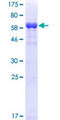 RRM2 Protein - 12.5% SDS-PAGE of human RRM2 stained with Coomassie Blue