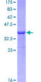 RRM2 Protein - 12.5% SDS-PAGE Stained with Coomassie Blue