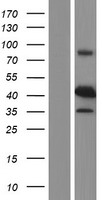 RRM2B / P53R2 Protein - Western validation with an anti-DDK antibody * L: Control HEK293 lysate R: Over-expression lysate