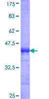 RRM2B / P53R2 Protein - 12.5% SDS-PAGE Stained with Coomassie Blue.