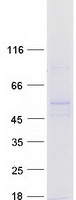 RRNAD1 / C1orf66 Protein - Purified recombinant protein RRNAD1 was analyzed by SDS-PAGE gel and Coomassie Blue Staining