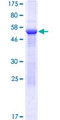 RRP15 Protein - 12.5% SDS-PAGE of human RRP15 stained with Coomassie Blue