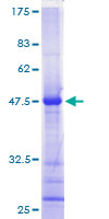 RRP22 / RASL10A Protein - 12.5% SDS-PAGE of human RRP22 stained with Coomassie Blue