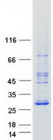 RRP22 / RASL10A Protein - Purified recombinant protein RASL10A was analyzed by SDS-PAGE gel and Coomassie Blue Staining