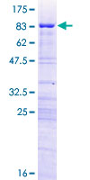 RRP8 Protein - 12.5% SDS-PAGE of human KIAA0409 stained with Coomassie Blue