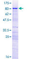 RRP8 Protein - 12.5% SDS-PAGE of human KIAA0409 stained with Coomassie Blue