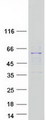 RRP8 Protein - Purified recombinant protein RRP8 was analyzed by SDS-PAGE gel and Coomassie Blue Staining