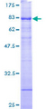 RRP9 Protein - 12.5% SDS-PAGE of human RNU3IP2 stained with Coomassie Blue