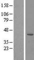 RRS1 Protein - Western validation with an anti-DDK antibody * L: Control HEK293 lysate R: Over-expression lysate