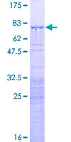 RRS1 Protein - 12.5% SDS-PAGE of human RRS1 stained with Coomassie Blue