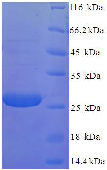 RS1 / Retinoschisin 1 Protein