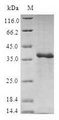 RS1 / Retinoschisin 1 Protein - (Tris-Glycine gel) Discontinuous SDS-PAGE (reduced) with 5% enrichment gel and 15% separation gel.