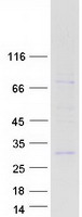 RS1 / Retinoschisin 1 Protein - Purified recombinant protein RS1 was analyzed by SDS-PAGE gel and Coomassie Blue Staining