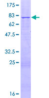 RSAD1 Protein - 12.5% SDS-PAGE of human RSAD1 stained with Coomassie Blue