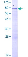 RSBN1 Protein - 12.5% SDS-PAGE of human RSBN1 stained with Coomassie Blue