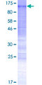 RSBN1L Protein - 12.5% SDS-PAGE of human RSBN1L stained with Coomassie Blue