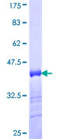 RSC1A1 Protein - 12.5% SDS-PAGE Stained with Coomassie Blue.