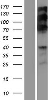 RSF1 / RSF-1 Protein - Western validation with an anti-DDK antibody * L: Control HEK293 lysate R: Over-expression lysate