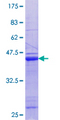 RSF1 / RSF-1 Protein - 12.5% SDS-PAGE Stained with Coomassie Blue.