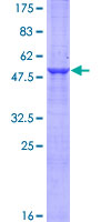 RSG1 Protein - 12.5% SDS-PAGE of human C1orf89 stained with Coomassie Blue