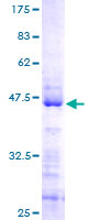 RSL24D1 Protein - 12.5% SDS-PAGE of human C15orf15 stained with Coomassie Blue