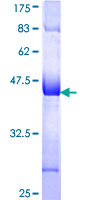 RSPH1 / TSGA2 Protein - 12.5% SDS-PAGE Stained with Coomassie Blue.