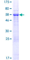 RSPH14 / RTDR1 Protein - 12.5% SDS-PAGE of human RTDR1 stained with Coomassie Blue