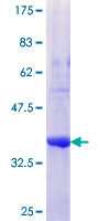 RSPH14 / RTDR1 Protein - 12.5% SDS-PAGE Stained with Coomassie Blue.