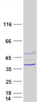 RSPH14 / RTDR1 Protein - Purified recombinant protein RSPH14 was analyzed by SDS-PAGE gel and Coomassie Blue Staining