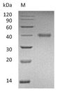 RSPO1 / RSPO Protein - (Tris-Glycine gel) Discontinuous SDS-PAGE (reduced) with 5% enrichment gel and 15% separation gel.