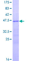 RSPO2 Protein - 12.5% SDS-PAGE of human RSPO2 stained with Coomassie Blue