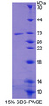 RSPO3 Protein - Recombinant  R-Spondin 3 By SDS-PAGE