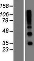 RSPO4 Protein - Western validation with an anti-DDK antibody * L: Control HEK293 lysate R: Over-expression lysate