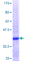 RSU1 Protein - 12.5% SDS-PAGE Stained with Coomassie Blue.