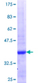 RSU1 Protein - 12.5% SDS-PAGE Stained with Coomassie Blue.