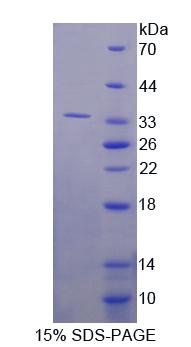 RSU1 Protein - Recombinant Ras Suppressor Protein 1 By SDS-PAGE