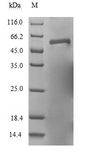 RSV F0 Protein - (Tris-Glycine gel) Discontinuous SDS-PAGE (reduced) with 5% enrichment gel and 15% separation gel.