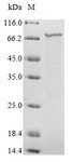 RSV F0 Protein - (Tris-Glycine gel) Discontinuous SDS-PAGE (reduced) with 5% enrichment gel and 15% separation gel.