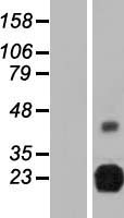 RTBDN / Retbindin Protein - Western validation with an anti-DDK antibody * L: Control HEK293 lysate R: Over-expression lysate