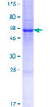 RTBDN / Retbindin Protein - 12.5% SDS-PAGE of human RTBDN stained with Coomassie Blue
