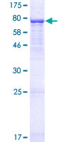RTCB / C22orf28 Protein - 12.5% SDS-PAGE of human C22orf28 stained with Coomassie Blue