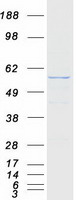 RTCB / C22orf28 Protein - Purified recombinant protein RTCB was analyzed by SDS-PAGE gel and Coomassie Blue Staining