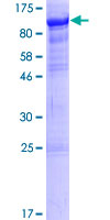 RTF1 Protein - 12.5% SDS-PAGE of human RTF1 stained with Coomassie Blue